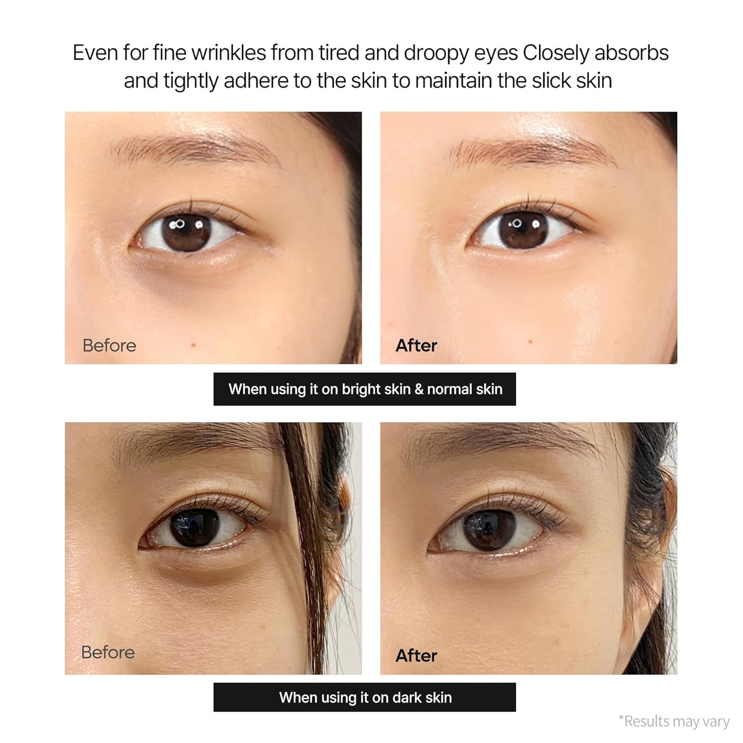 🔥LAST DAY 60% OFF!！Zeaaez™  Korean Calcium Dark Spot Eye Cream
