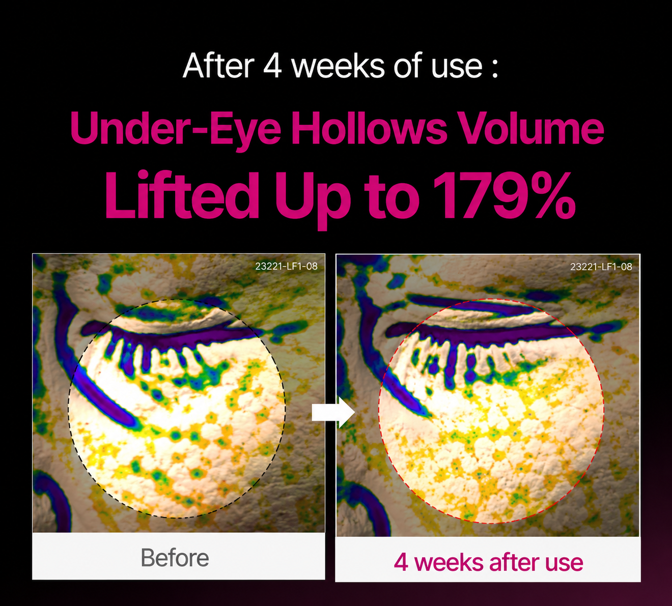 🔥LAST DAY 60% OFF!！Zeaaez™  Korean Calcium Dark Spot Eye Cream