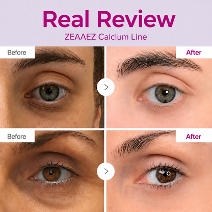 🔥LAST DAY 60% OFF!！Zeaaez™  Korean Calcium Dark Spot Eye Cream